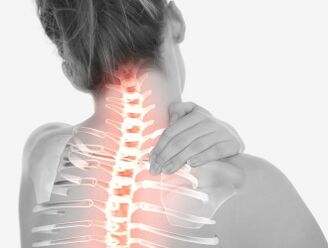 Osteochondrosis of the cervical area
